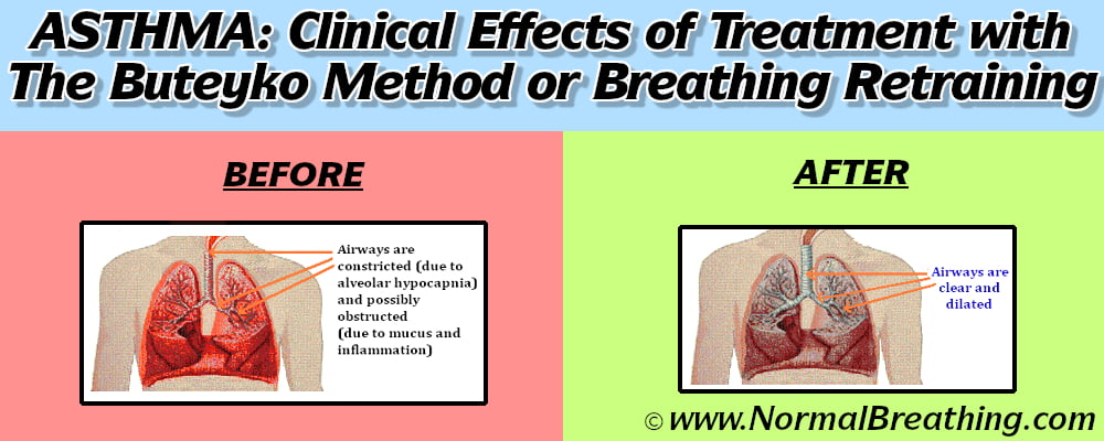 Asthma before and after treatment with the Buteyko method or breathing retraining