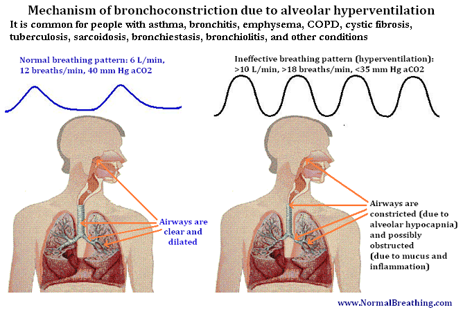 mechanism of natural bronchoconstriction for untreated COPD-emphysema