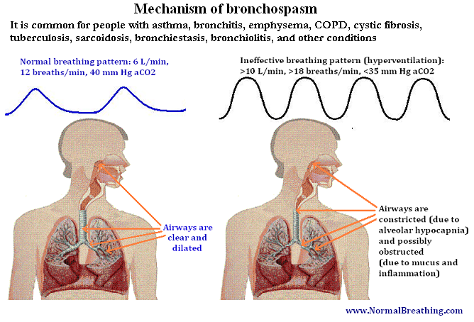 Bronchospasm mechanism