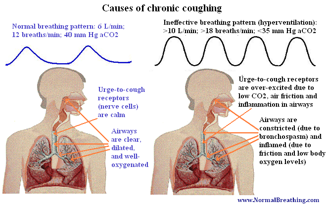 Cough mechanism (chart)