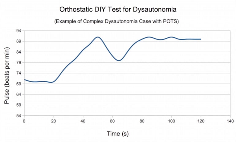 Dysautonomia dysfunction measured with orthostatic lying-standing DIY pulse test: parasympathetic-sympathetic autonomous disregulation