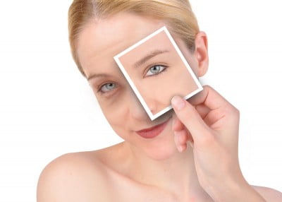 Woman with dark circles under eyes and photo covering one eye