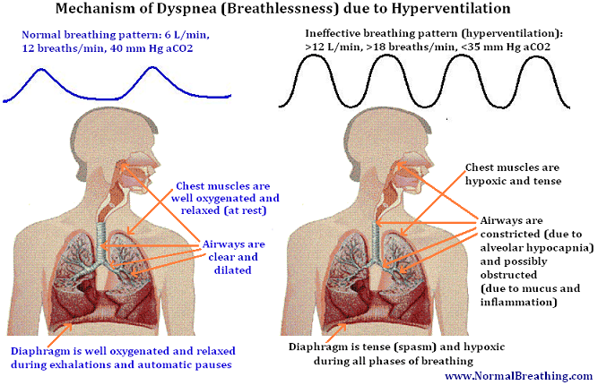 breathlessness mechanism and weak respiratory muscle causes