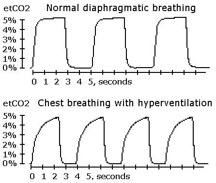 End-tidal CO2 (etCO2) capnography waveforms for diaphragmatic and chest breathing