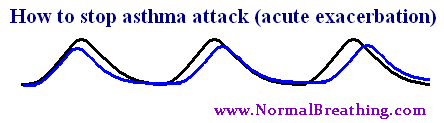 How to stop asthma attack (acute exacerbation) - chart