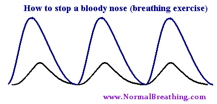 How to stop a blood nose (breathing exercise)