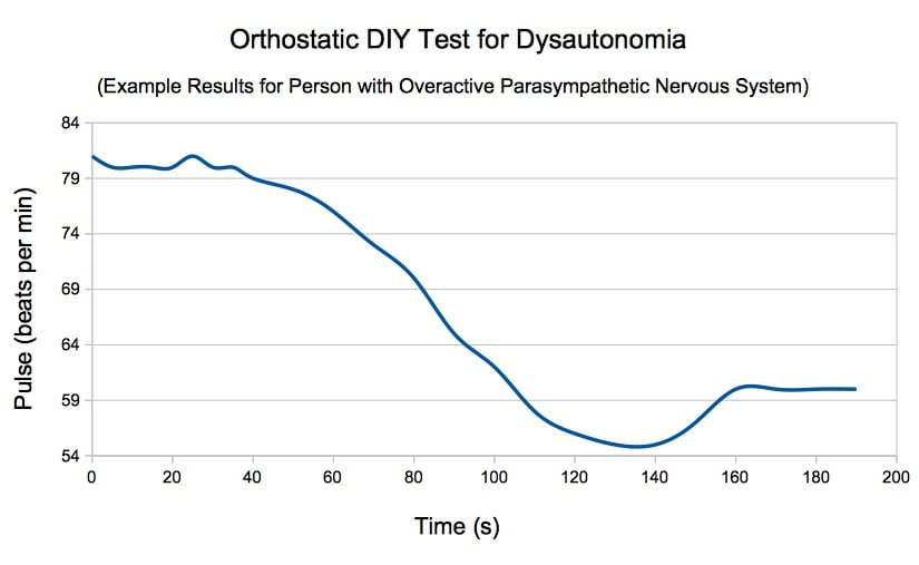 dysautonomia orthostatic test for parasympathetic nervous system; pulse change in time for unhealthy person from standing to lying