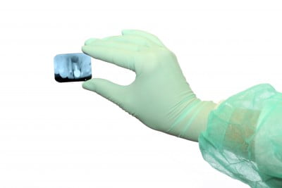 Root canal X ray