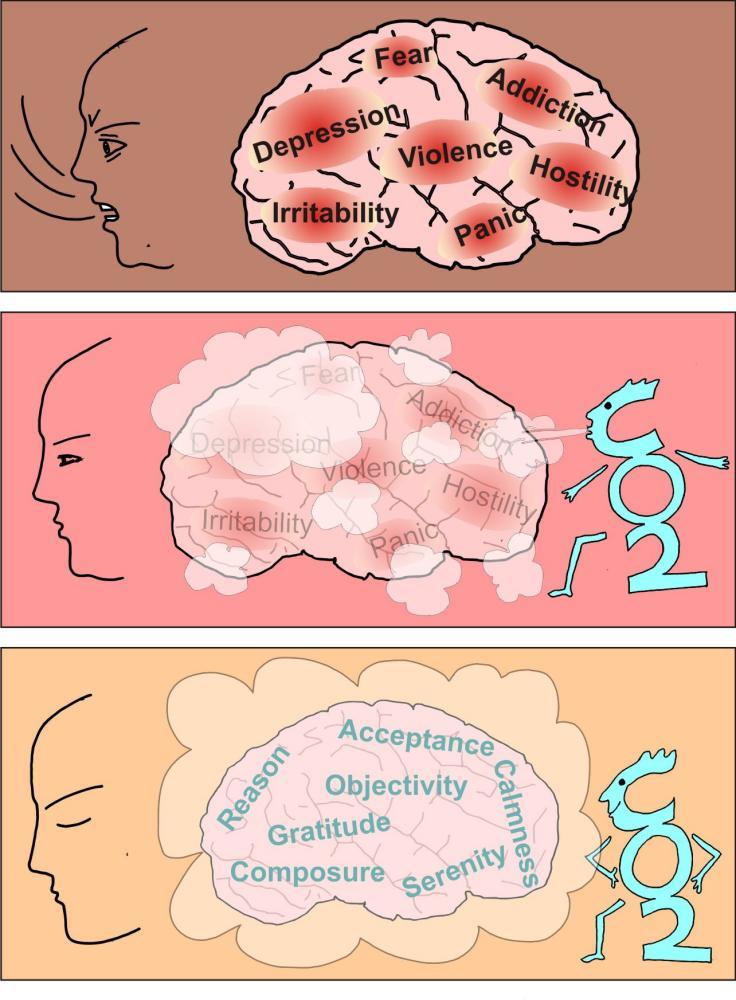 Effects of natural sedative CO2 Stabilizer on the brain