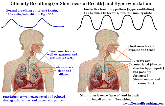 Shortness of breath (difficulties breathing) and hypocapnia