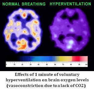 Effects of overbreathing on brain O2 and sleep seizures