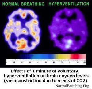 Breathing Retraining: Health Therapy That Always Works 2