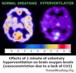 Brain O2 levels for normal breathing and after hyperventilation